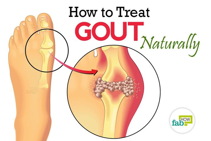How To Get Rid Of Uric Acid Build Up Naturally How To Get Rid Of Uric Acid Build Up Naturally