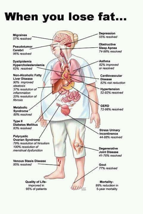Weight loss for 68 year old woman image 9