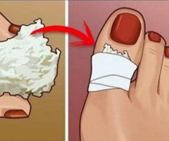 merita sa facei o intervenie chirurgicala în varicoza creme mazi pentru tratamentul varicoselor