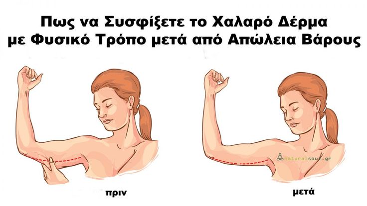 Είμαι 49 ετών και πρέπει να χάσω βάρος Καφές stbotanica 4d για απώλεια βάρους