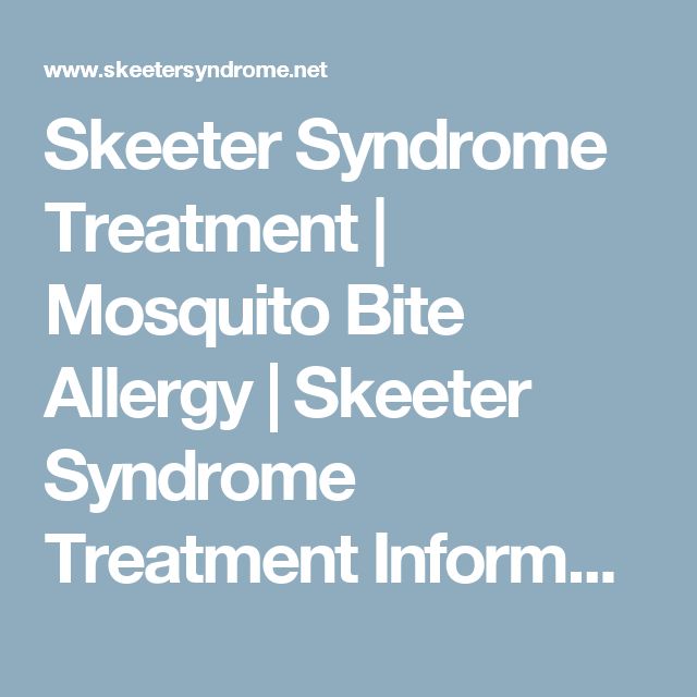 Natural Remedies For Mosquito Bite Allergy Natural Remedies For Mosquito Bite Allergy