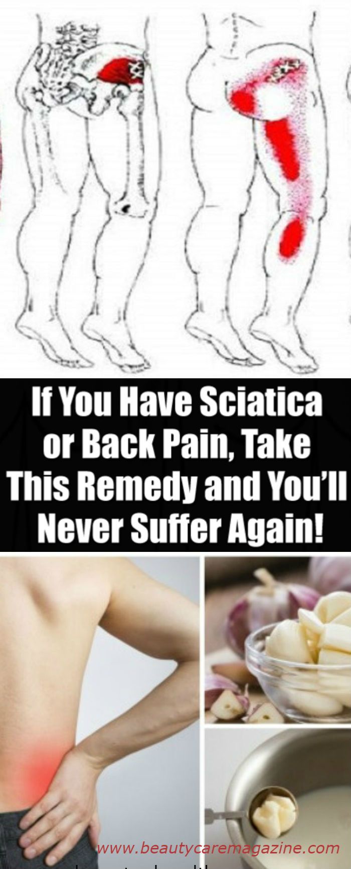 Natural Remedy To Cure Herniated Disc Natural Remedy To Cure Herniated Disc