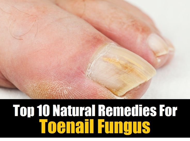 Find high quality herbal remedies