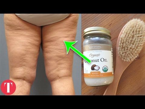 How To Get Rid Of Adhesions Naturally How To Get Rid Of Adhesions Naturally