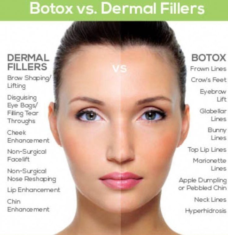 The difference between Botox & Fillers Botox contains purified bacteria that freeze muscles. In doing so Botox can help minimize the appearance of lines and wrinkles caused by facial expressions. Dermal fillers contain ingredients that add fullness to areas that have thinned due to aging. This thinning is common in the cheeks lips and around the mouth. .
