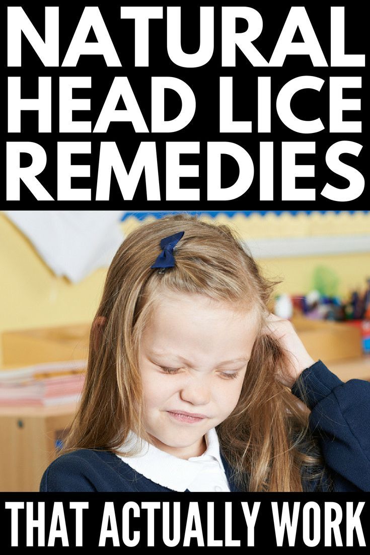 Natural Head Lice Remedies That Work Natural Head Lice Remedies That Work