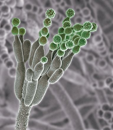 scanning electron microscope sem image of a spore environmental scanning