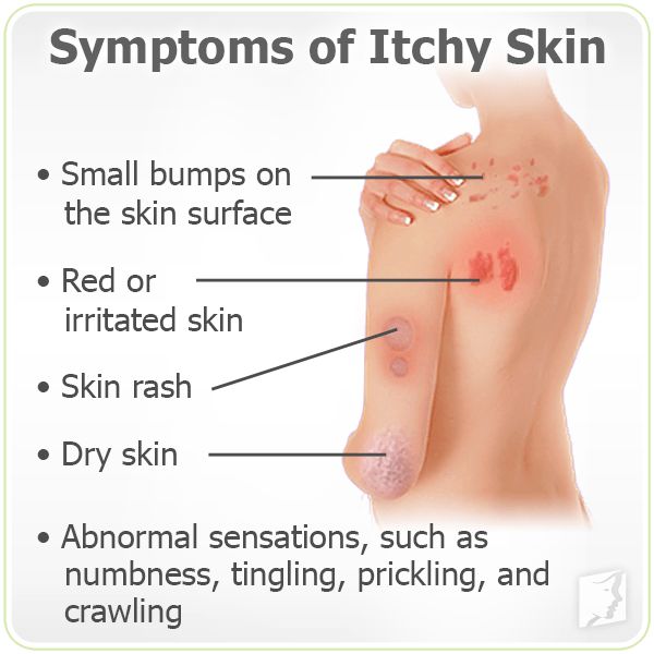 Why Are My Nipples Dry And Itchy