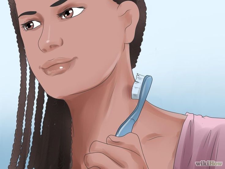 How to Get Rid of a Hickey Fast 2 Most Effective Ways