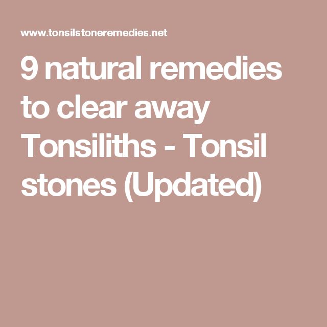 How To Get Rid Of Tonsiliths Naturally How To Get Rid Of Tonsiliths Naturally