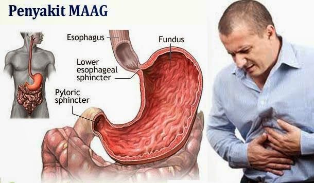 Grosir 0823 1337 5758 Obat Madu Darah Tinggi Dan Stroke Serta Asam Lambung Badung Madu Darah Asam Urat