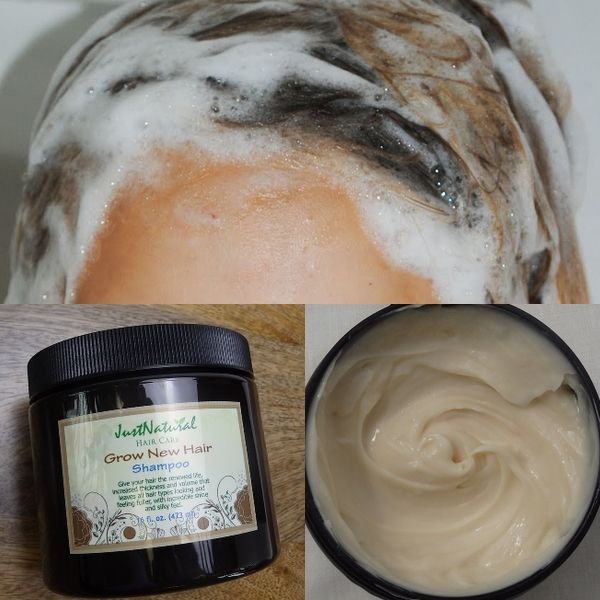 How To Get Rid Of Bald Spots On Head Naturally How To Get Rid Of Bald Spots On Head Naturally