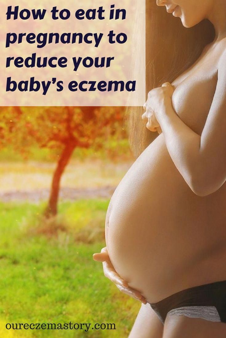 Pregnant #women #can #help #prevent #infant #eczema #How #to #eat #in #pregnancy #to #reduce #your #baby’s #eczema #Pregnant #diet #| #pregnant #diet #plan #| #pregnant #diet #first #trimester #| #pregnant #diet #recipes #| #pregnant #diet #plan #first #trimester| #Eczema #remedies #| #eczema #remedies #for #kids #| #eczema #essential #oils #| #eczema #remedies #for #babies #| #eczema #treatment #| #The #Eczema #Company #| #Eczema #Cream #Hub #| #Eczema #Treatment #Center #| #Eczema #Treatment # #eczemasolutions