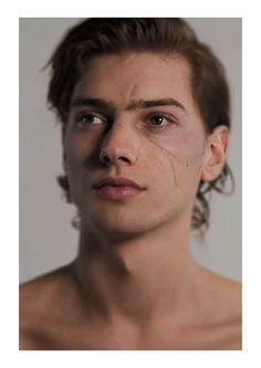 men with facial scars Bellevue big cock