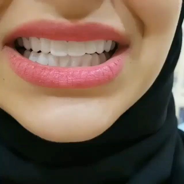 حيث تتم تصميم ابتسامة هوليود بواسطة الزيركون خلال 4 ايام فقط ابتسامة طبيعية جديدة لحياتك في مركزنا صممت على ايدي افضل الأطباء والخبراء تجميل الأسنان اتر Teeth