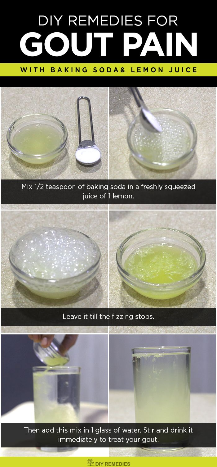 Gout Natural Remedies Cure Gout Natural Remedies Cure