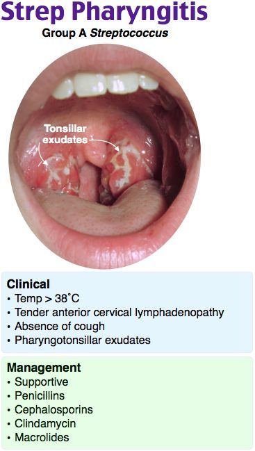 an image of the inside of a person's mouth with words describing their stages