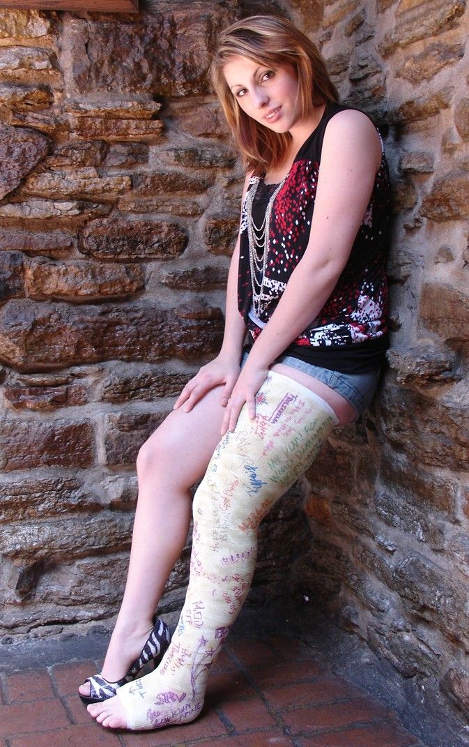Leg Cast Fashion Tips 14 Pin by As As.as. on broken ankle Long leg cast, Leg cast