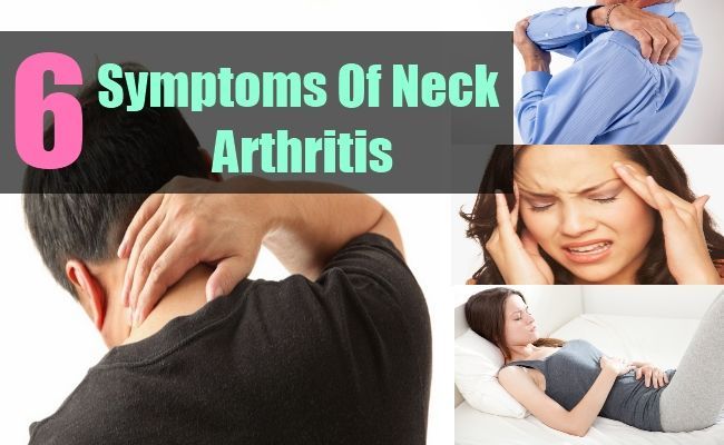 Natural Remedies For Arthritis In Hands And Neck Natural Remedies For Arthritis In Hands And Neck
