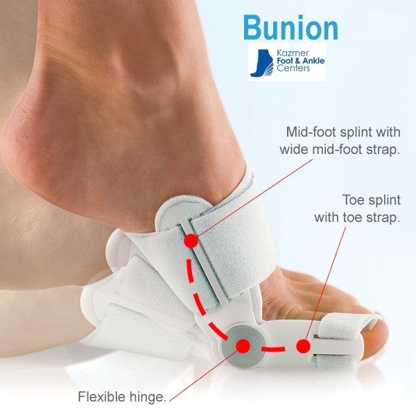 Can Arthritis Be Treated Naturally Can Arthritis Be Treated Naturally