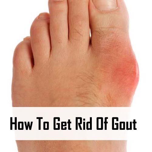How To Get Rid Of Gout In Big Toe Naturally How To Get Rid Of Gout In Big Toe Naturally