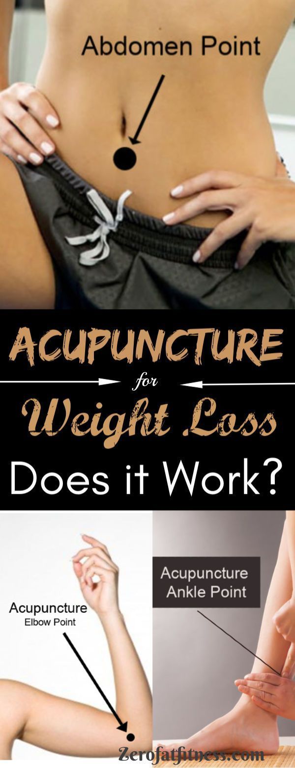 Pin On Acupunctuur