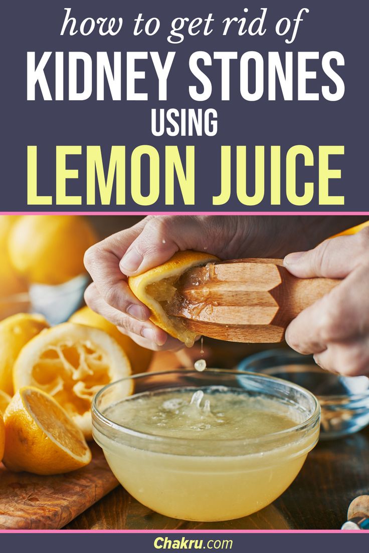 Get Rid Of Kidney Stones Using Lemon Juice Kidney Stones Kidney get-rid-of-kidney-stones-using-lemon-juice-kidney-stones-kidney