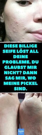 Jan 15, 2020 - 10 Probleme, für die Kernseife eine schnelle Lösung ist. - #die #eine #für #Ist #Kernseife #Lösung #Probleme #Schnelle