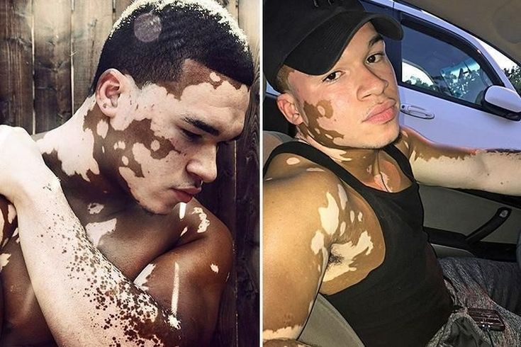Schwarze frauen nacktfotos suchen weiße männer