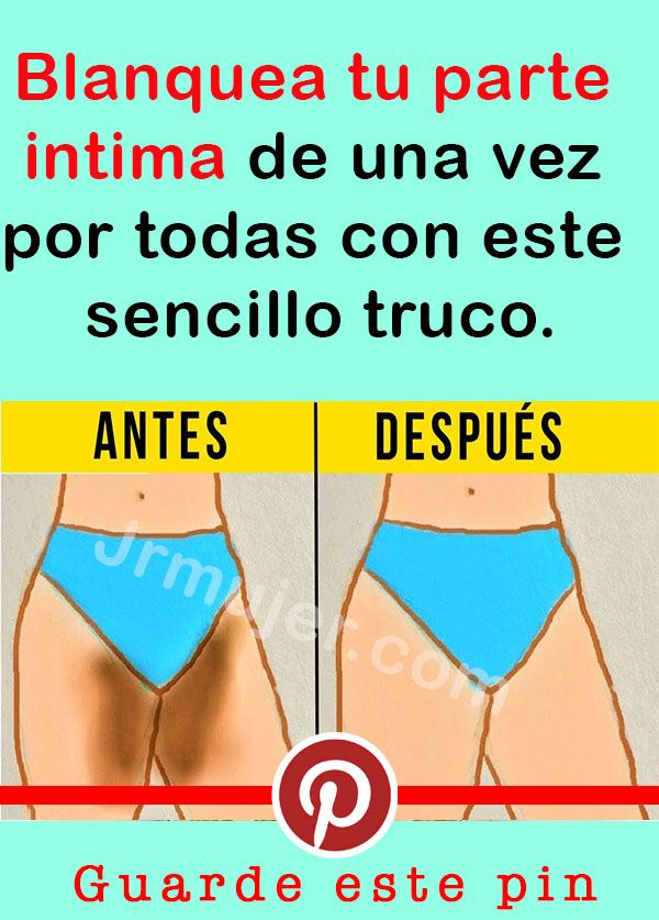 Pin On Belleza