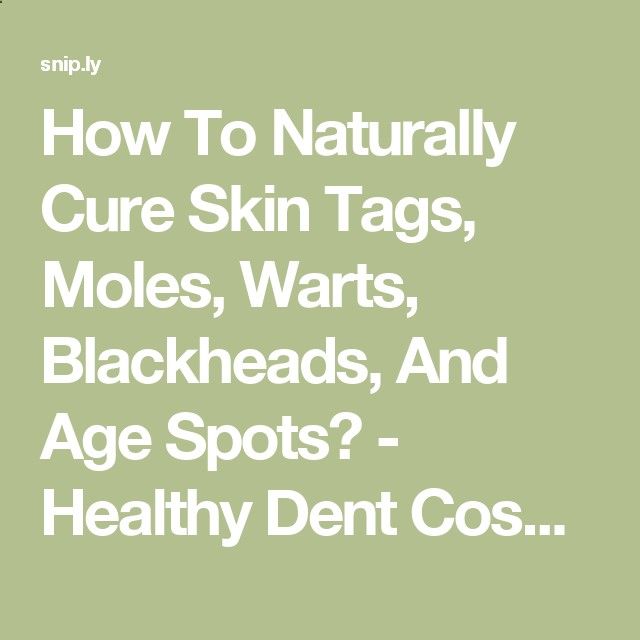 How To Cure Warts On Fingers Naturally How To Cure Warts On Fingers Naturally
