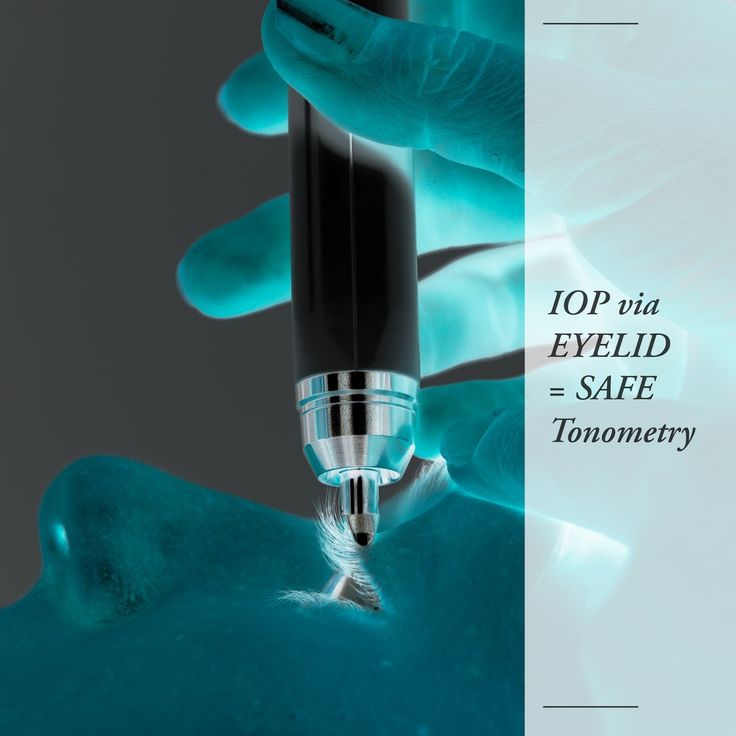 concussion flickery eyesight concussion flickery eyesight