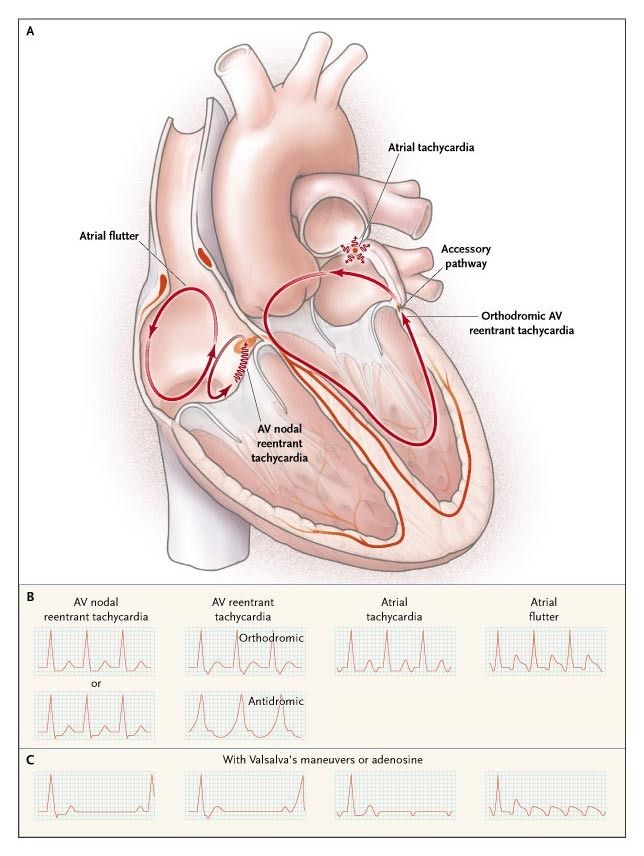 Diet plans to reduce blood pressure picture 2