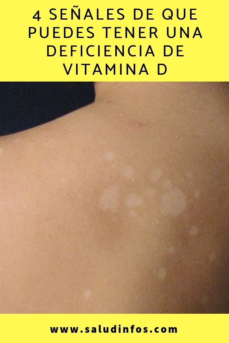 efectos de deficiencia de vitamina d efectos de deficiencia de vitamina d