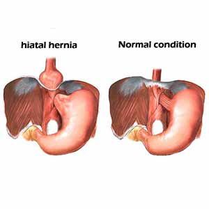 Acid Reflux In Dogs Natural Treatment Acid Reflux In Dogs Natural Treatment