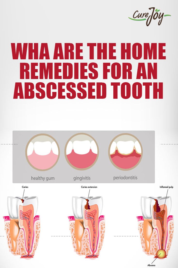 Popular Abscess at home remedies with New Ideas