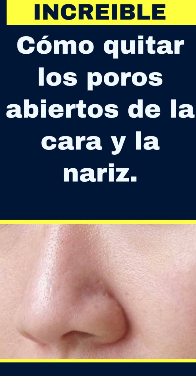 Pin On Belleza