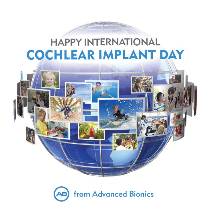an overview of cochlear implants Cochlear implants home overview of cochlear implants cochlear cochlear implants bypass damaged portions of the ear and directly. an overview of cochlear implants Cochlear implants home overview of cochlear implants cochlear cochlear implants bypass damaged portions of the ear and directly.