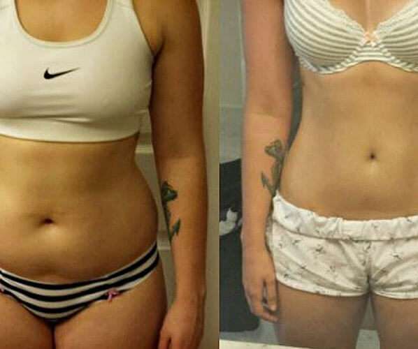 Antes Y Despues Clembuterol Antes Y Despues Clembuterol
