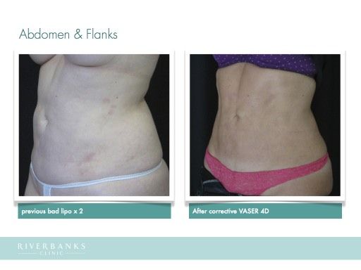 Can rapid weight loss cause spotting picture 5