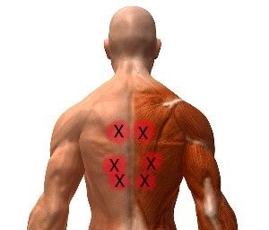 Best 20 Middle back pain causes ideas on Pinterest | Spine pain ... Best 20 Middle back pain causes ideas on Pinterest | Spine pain ...