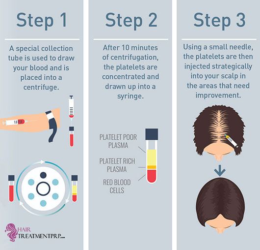 #Platelets #Wealthy #Plasma, or #PRP, is a substance that thinks about creating #… #Platelets #Wealthy #Plasma, or #PRP, is a substance that thinks about creating #…