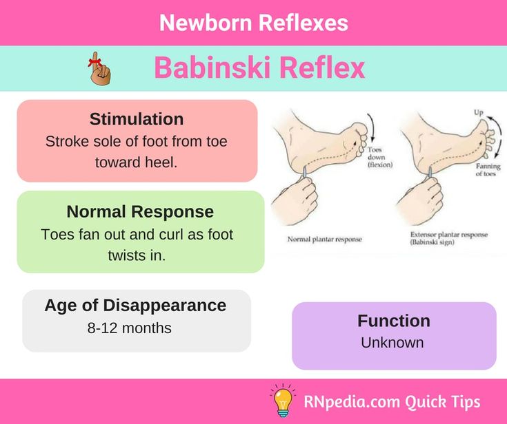 Newborn Reflexes RNpedia Neonatal Nurse Pediatric Nursing Nursing occupational-therapy-infographic-sheets-chicago-occupational-therapy