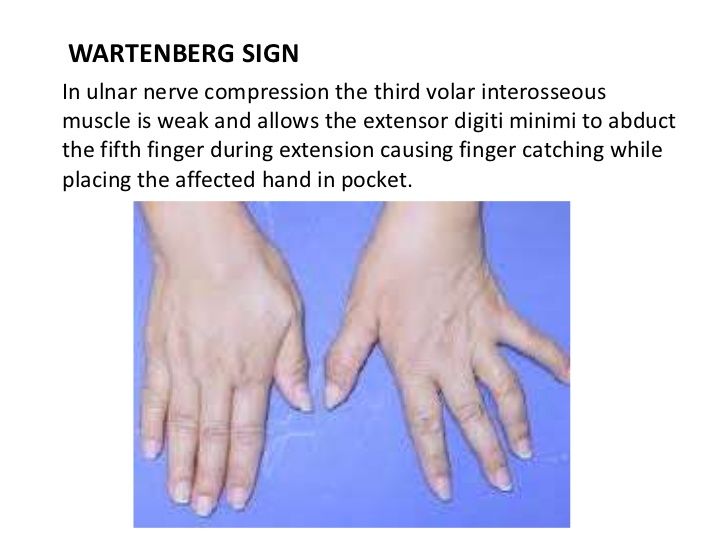 ulnar nerve compression ulnar nerve compression