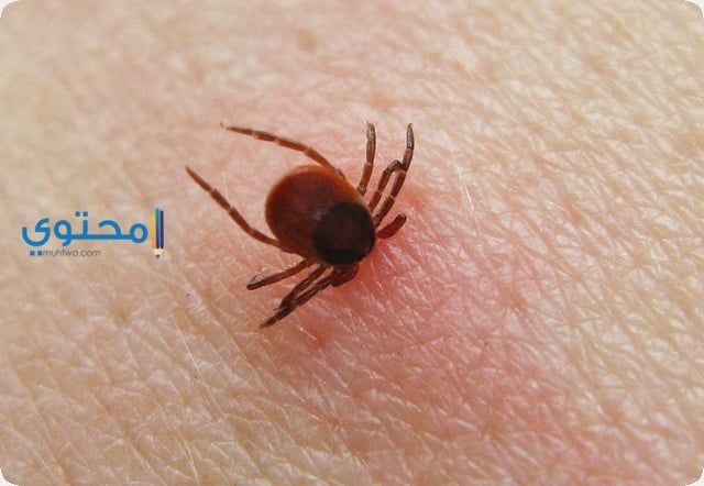تفسير رؤية البرغوث فى الحلم بالتفصيل in 2020 Spider, Insects
