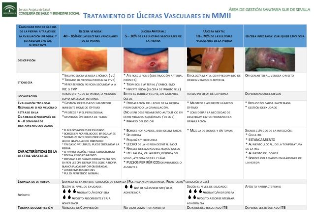 Tratamiento De úlceras Vasculares En Mmii Clasificar Tipo De úlcera De La Pierna A Través De La Evaluación Integral Y Esta