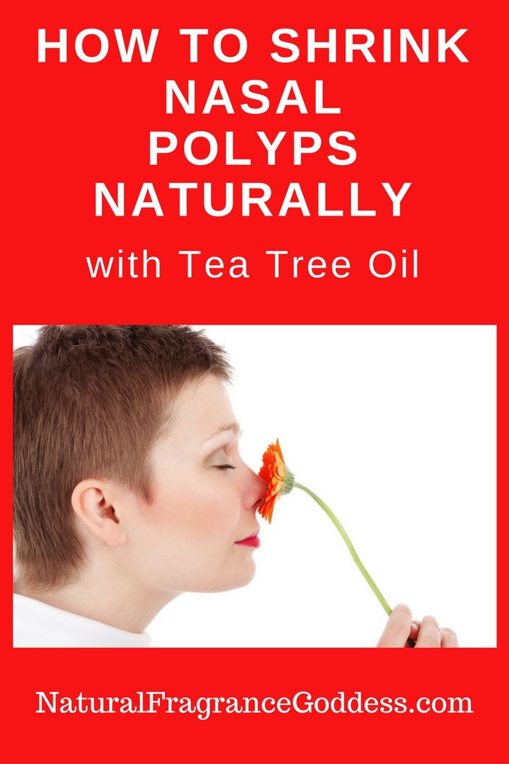 How To Get Rid Of Stomach Polyps Naturally How To Get Rid Of Stomach Polyps Naturally