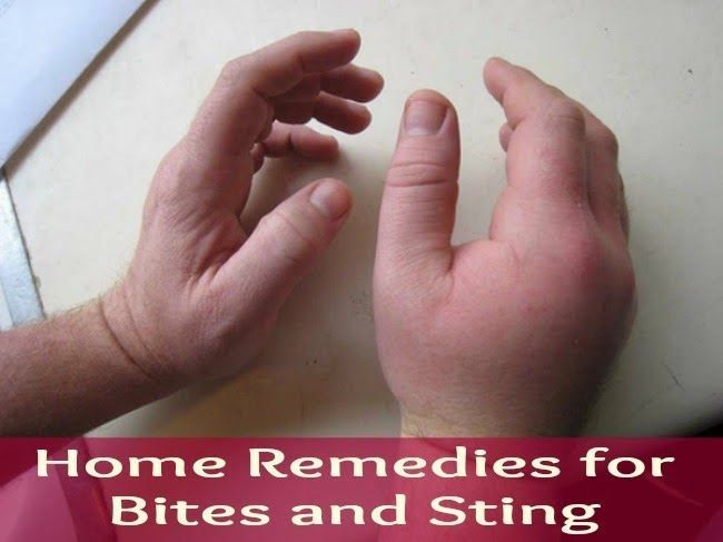 Best Natural Cures For Stomach Flu Best Natural Cures For Stomach Flu