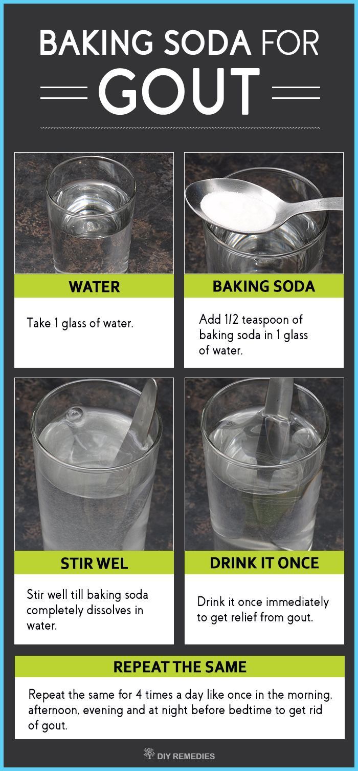 Natural Cures For Gout Baking Soda Natural Cures For Gout Baking Soda