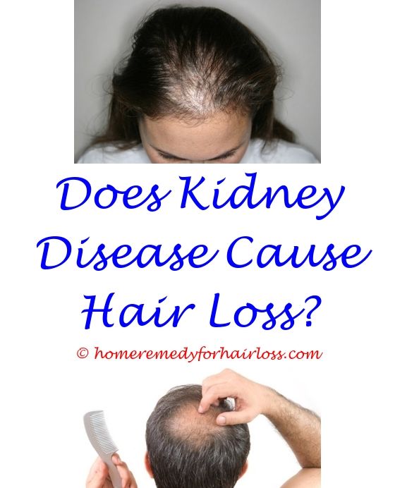 17 best Best Hair Loss Products images on Pinterest